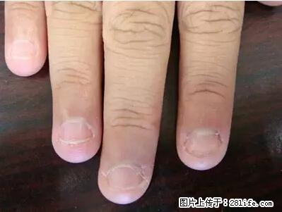 剪指甲、挖耳屎,这些日常小动作竟隐藏大危害! - 哈尔滨生活资讯 - 哈尔滨28生活网 hrb.28life.com